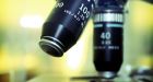Researchers hope twins will help unlock AIDS mysteries