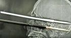 Man survives harpoon through skull with no brain damage