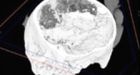 'Oldest human brain' discovered