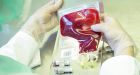 Tests aim to settle if fresher blood works better