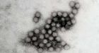 19 suspected outbreaks of Norovirus in Edmonton