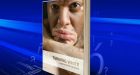 Canadian company makes skin disorder bearable