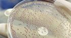 Supermarket chicken harbours superbugs