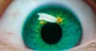 Researchers develop high-tech contact lens with sights on bionic eye