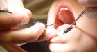 Dentist who used paper clips gets 1 year in jail