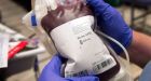 Fresh blood not better for transfusions, study shows